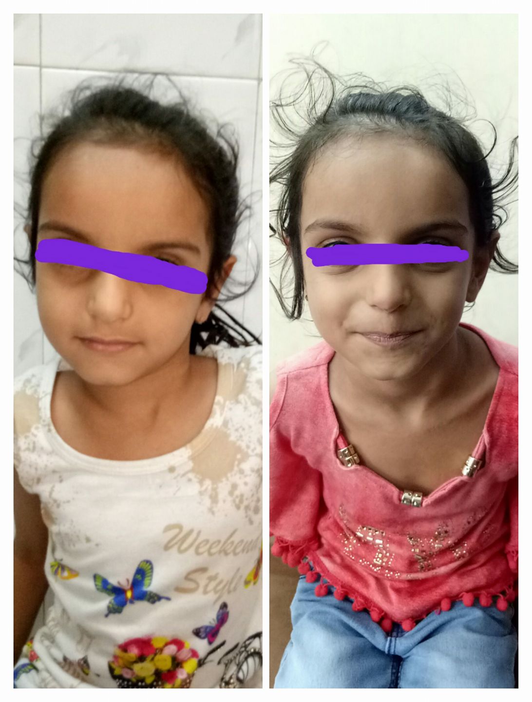 Pediatric facial clinical before-and-follow-up images with identity protected